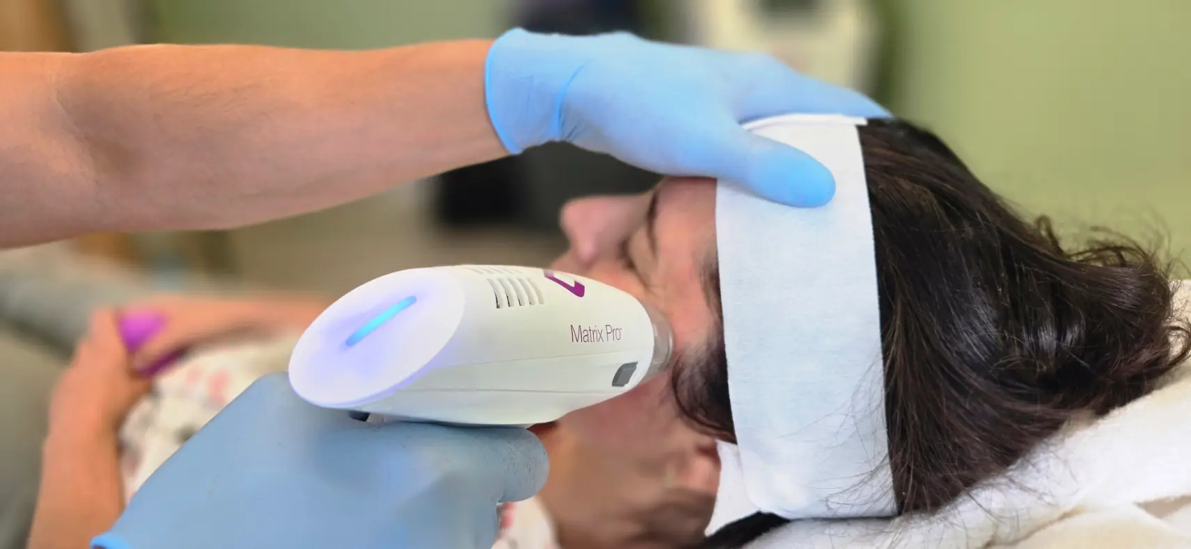 A photo of a client being treated with the Candela Matrix Pro.