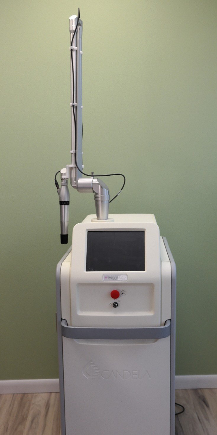 Candela PicoWay laser for tattoo removal in madison wi.